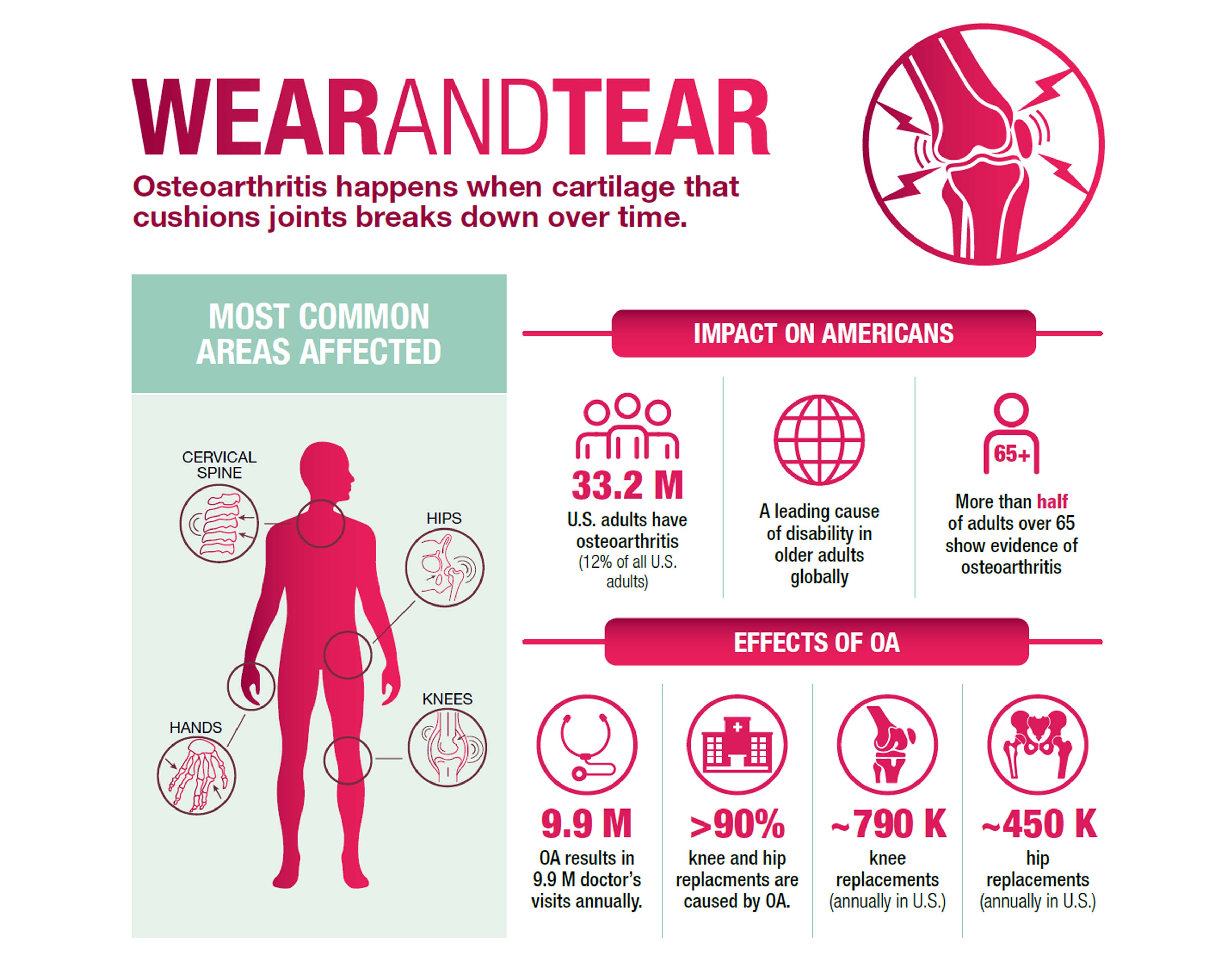 Sources: Centers for Disease Control and Prevention, National Institutes of Health, American Academy of Orthopedic Surgeons, American Association of Hip and Knee Surgeons, U.S. Department of Health and Human Services